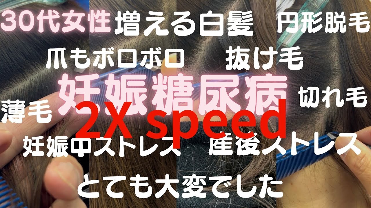 妊娠糖尿病でストレスで白髪も増え、薄毛になり、髪もくせ毛になり、爪もボロボロ、成長しない髪、とてもとても大変だったお話です。今は白髪を抜いてストレス解消！パンドガールで髪も、爪も回復しました。