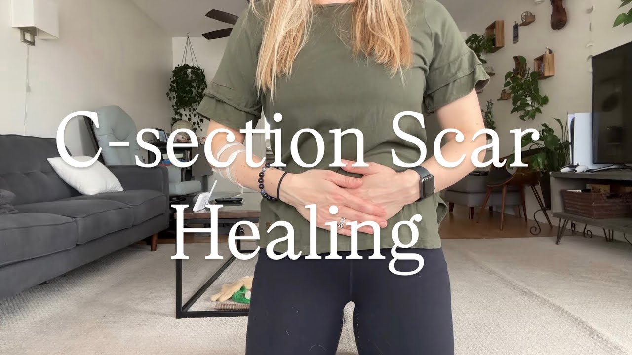 C-Section Scar Care: Massage & Sensory Reorganization Tips for Healing