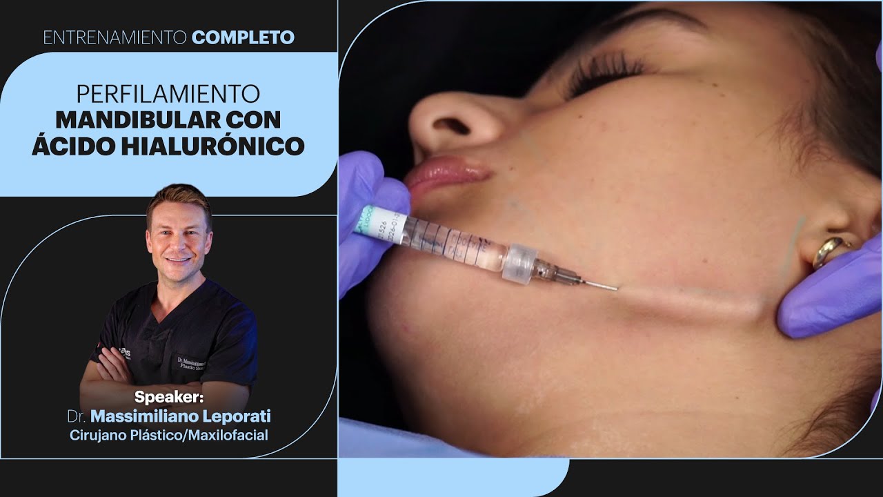 Perfilamiento Mandibular con Ácido Hialurónico - Dr. Massimiliano Leporati - Masterclass