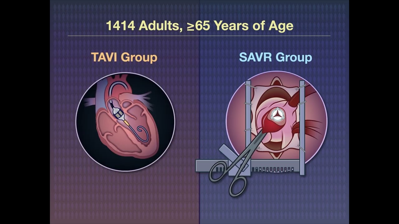 TAVI или SAVR при стенозе аортального клапана | NEJM