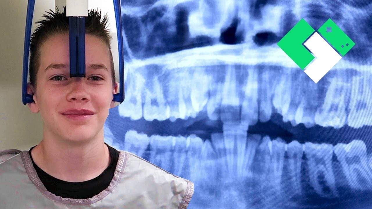 The Kids Are Finally Getting BRACES! | Clintus.tv