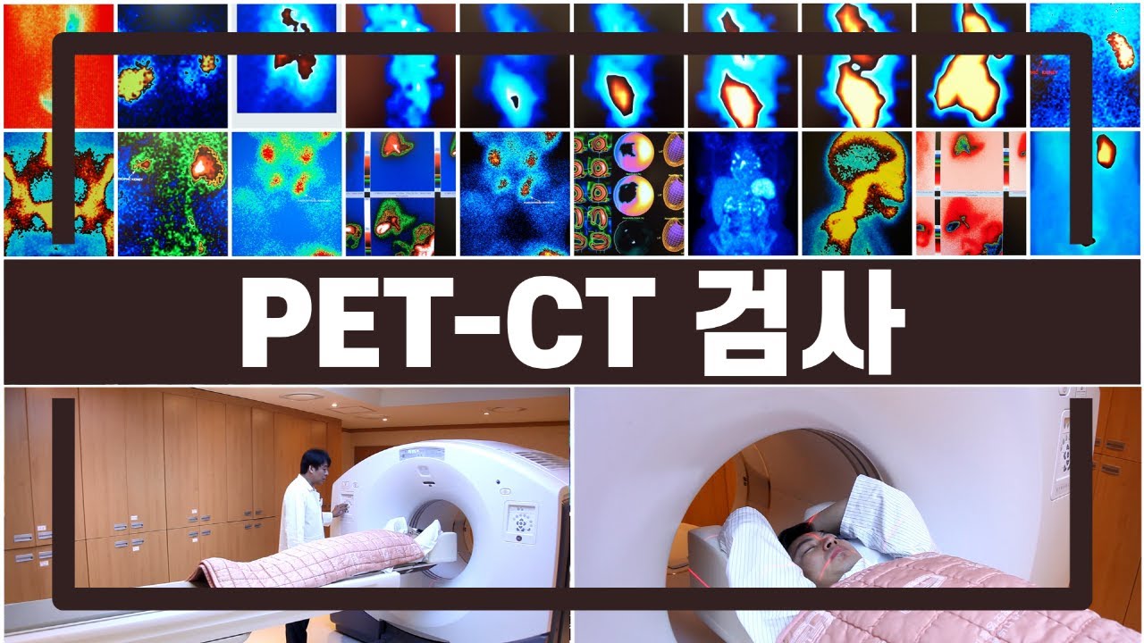 [서울성모병원] F-18 FDG를 이용한 PET-CT 검사