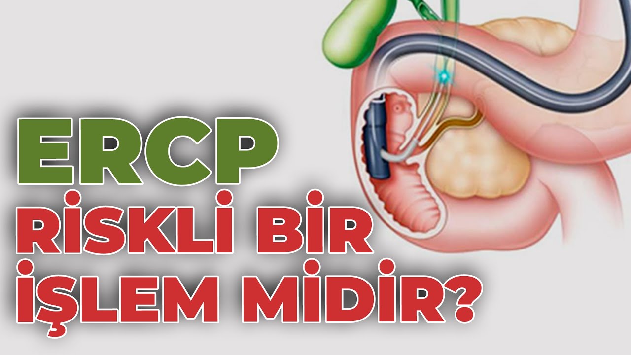 ERCP Nedir? ERCP Nasıl Yapılır? - Op. Dr. Ozan Andaç Erbil