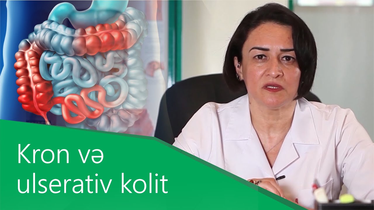 Müalicəyə çətin tabe olan bağırsağın iltihabi xəstəlikləri. Kron və ulserativ kolit.