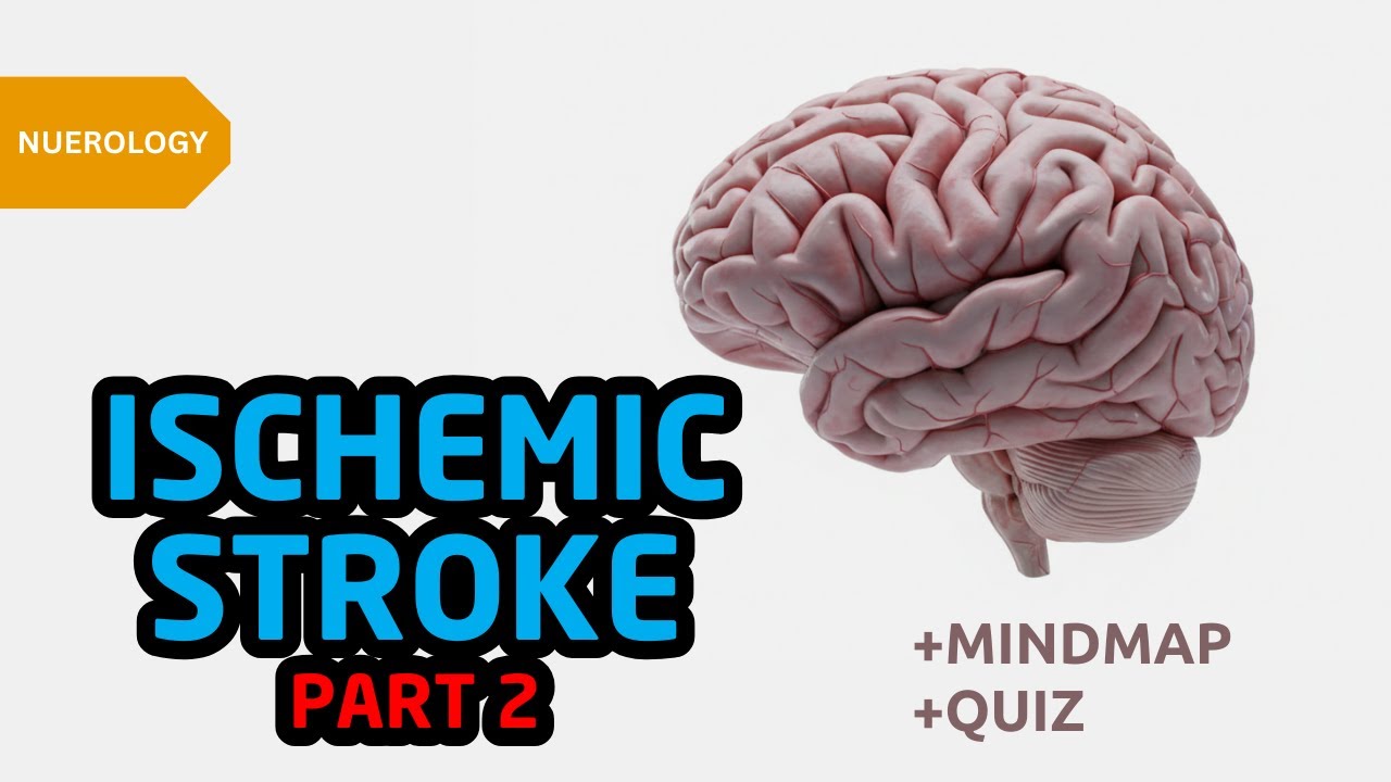 Ischemic Stroke Part 2: Reperfusion Therapy & Acute Management Explained