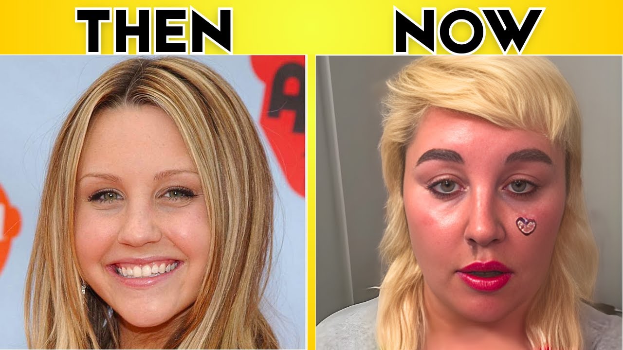 Zac Efron, Axl Rose & Amanda Bynes: Shocking Transformations! (Then and Now)