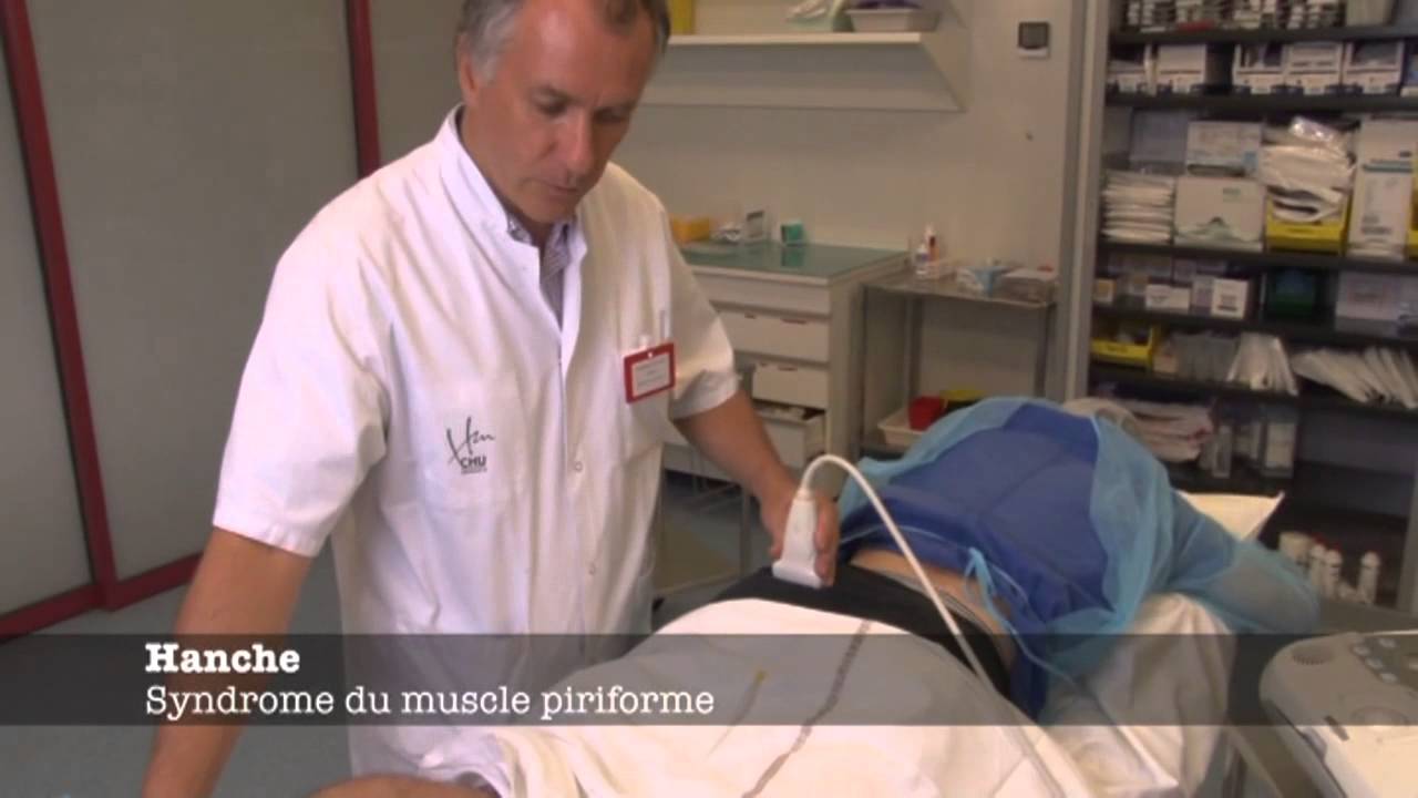 Echoms.info - Syndrome du Muscle piriforme