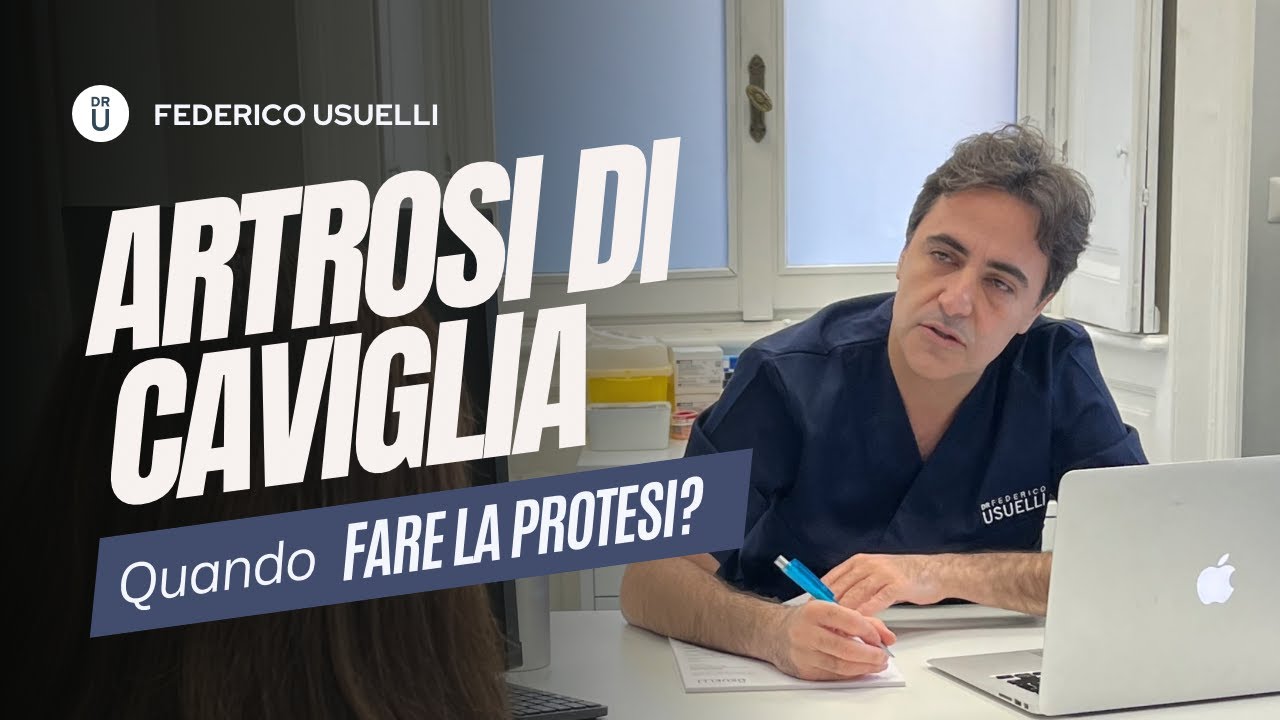 Artrosi di caviglia: se e quando pensare ad una protesi!