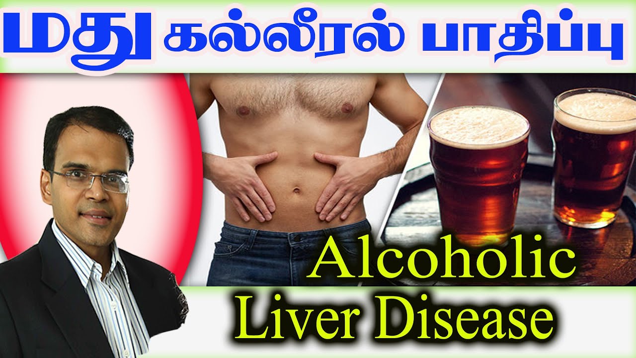Alcoholic Liver Disease மது கல்லீரல்பாதிப்பு Liver Failure Gasto Stop drinking  udumalpet Doctor