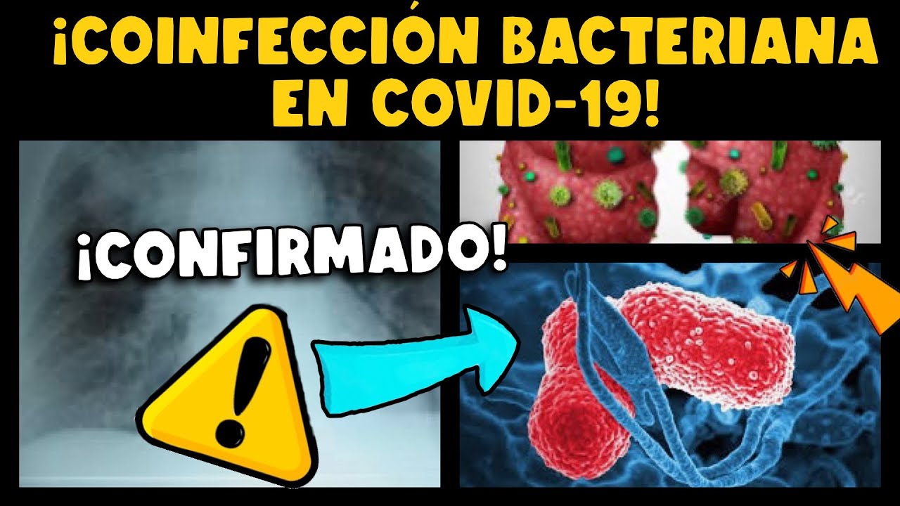&iexcl;ALERTA! CIENT&Iacute;FICOS CONFIRMAN QUE COINFECCI&Oacute;N BACTERIANA ES FACTOR DE RIESGO EN COVID-19