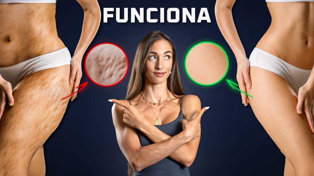Cómo Reducir tu CELULITIS para Siempre según la Ciencia