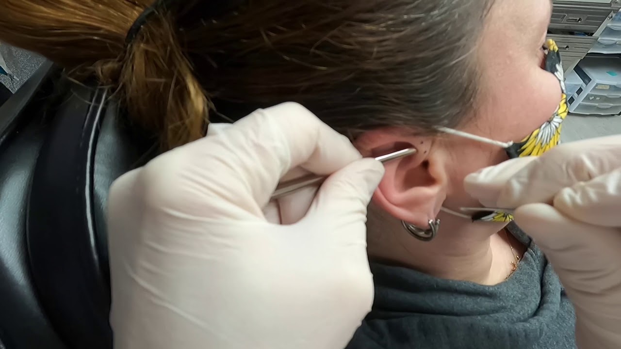 Triple forward helix