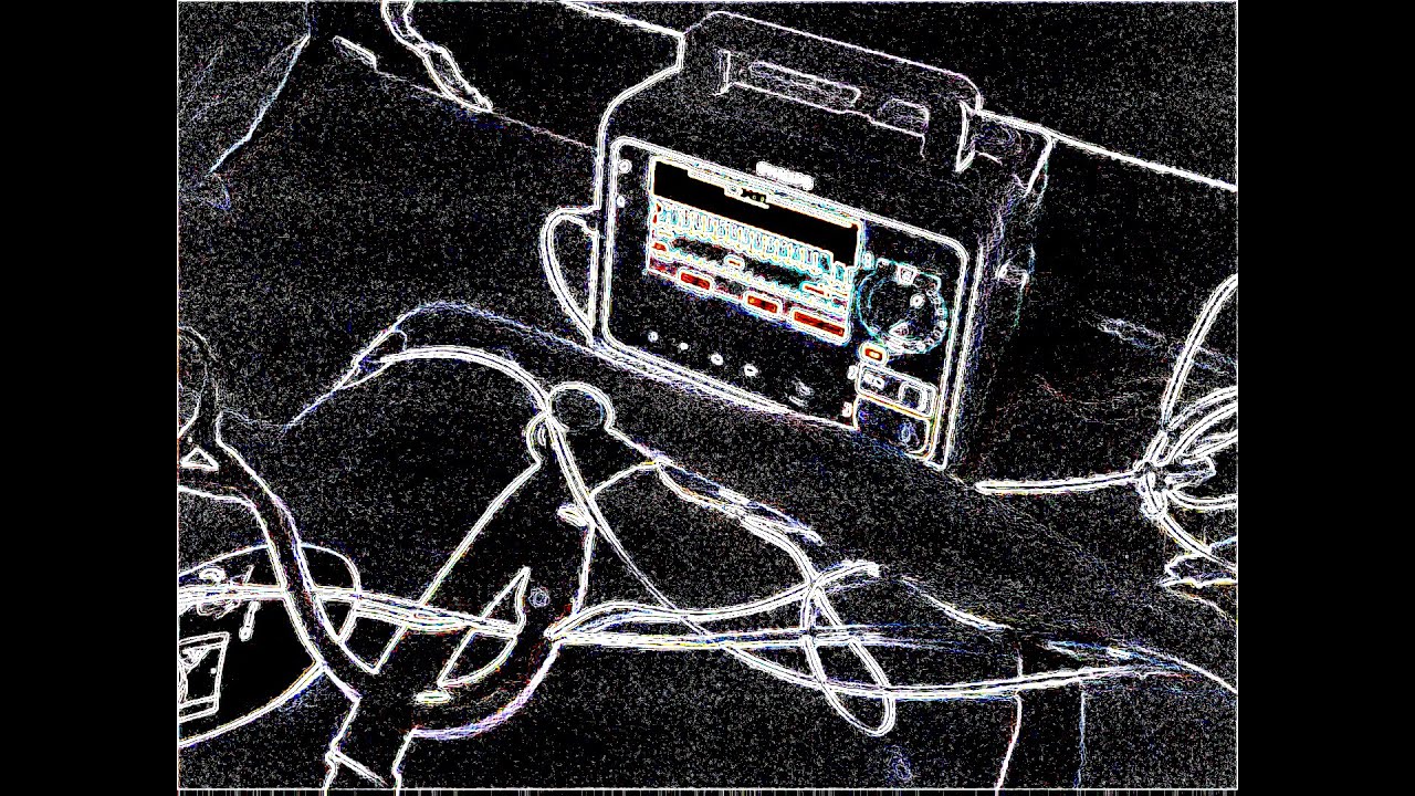 Synchronized Cardioversion on a Normal Person | Heartbeat