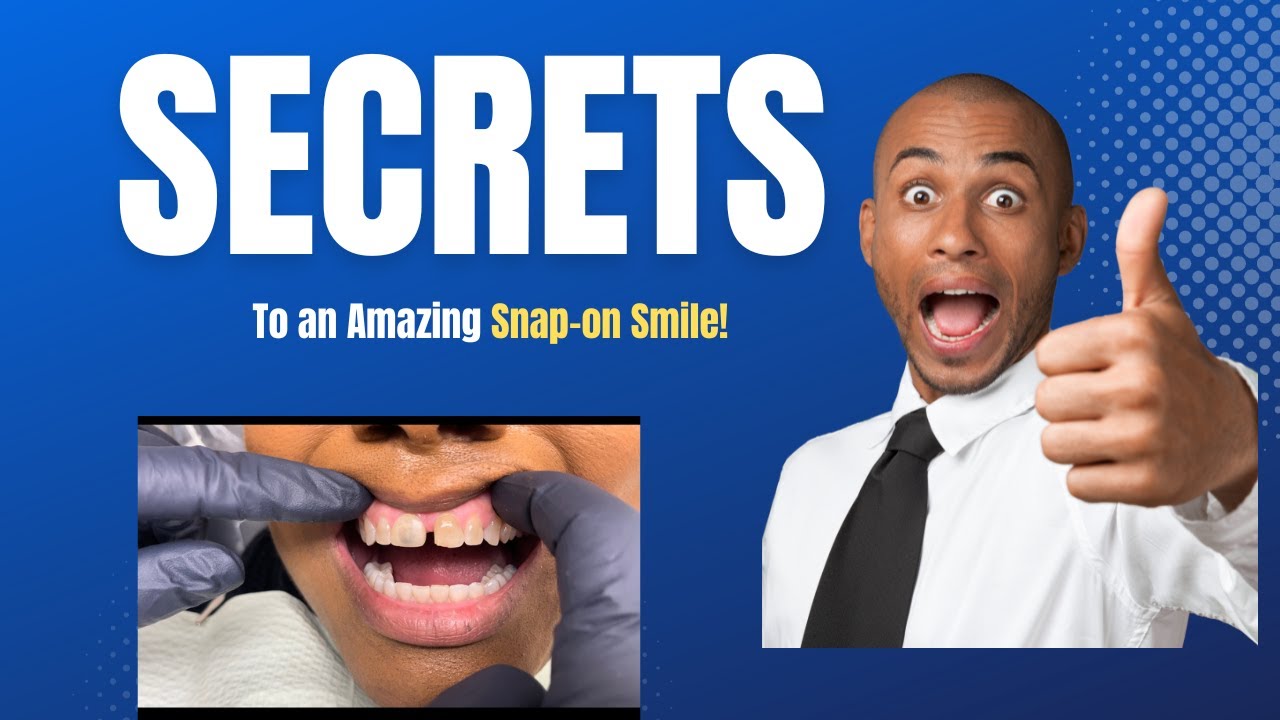 Fabulous! Snap-on Smile is just fabulous ❤️ Why they fit so well allowing you to eat with no issue!