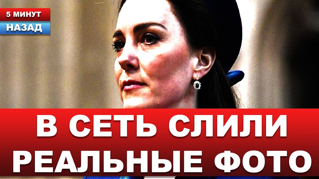 ЧЕСТНЫЕ ФОТО! Как в реальности выглядит Кейт Миддлтон после рака?