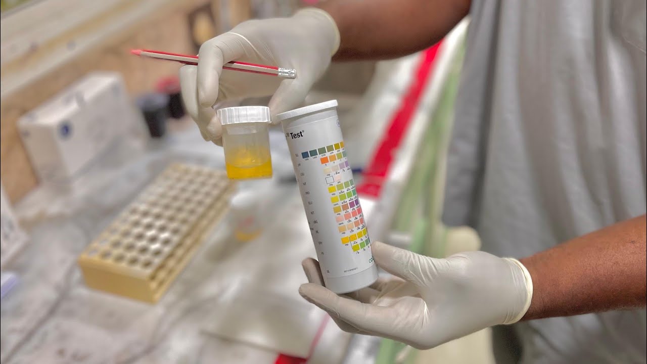 البول يدل على حالتك الصحيه  شرح عملي مختصر تحليل urine analysis بالتفصيل تحت المجهر under microscope