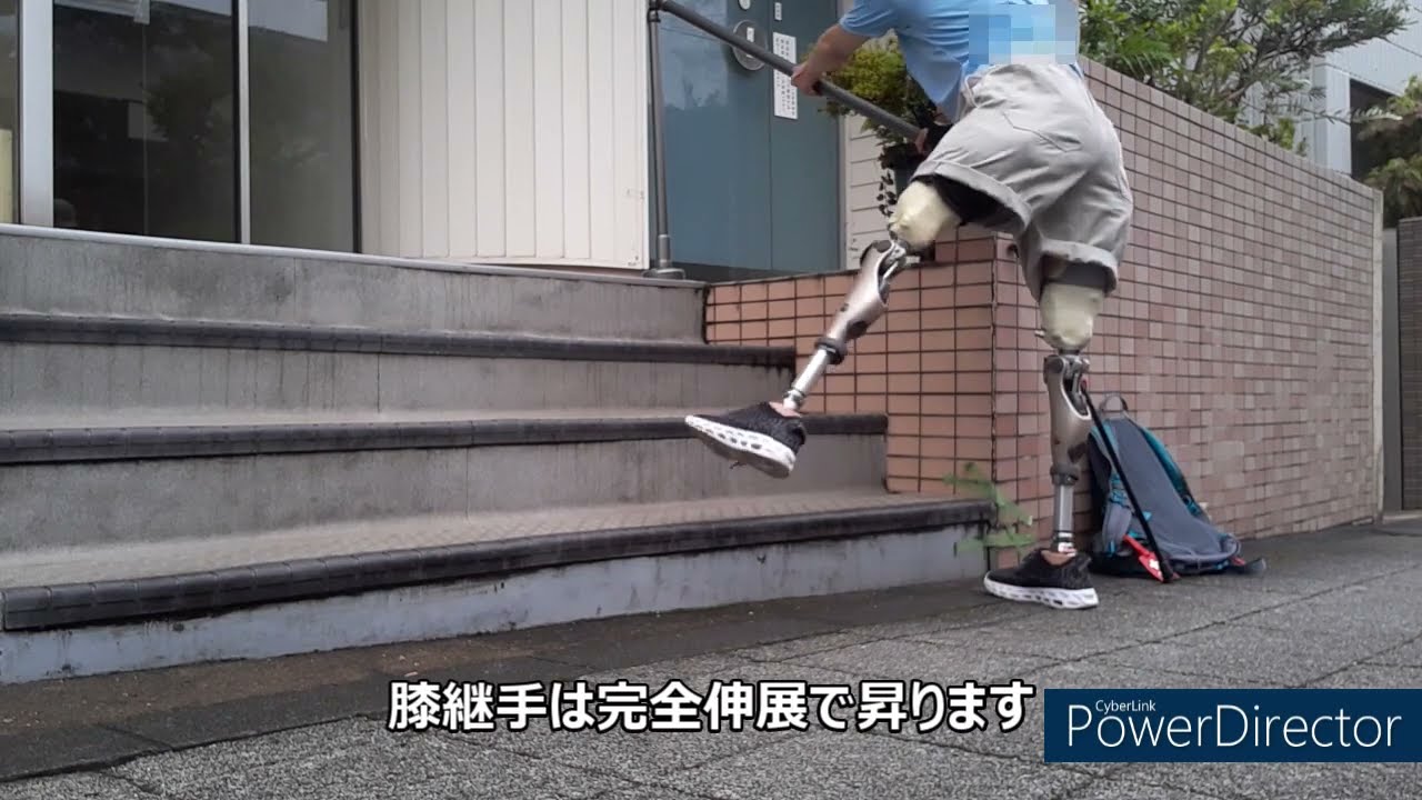 両足大腿義足ユーザーでの階段の昇り降り　#prosthesis #prostheticleg #prostheticlegs #義足 #義足ユーザー #義足リハビリ