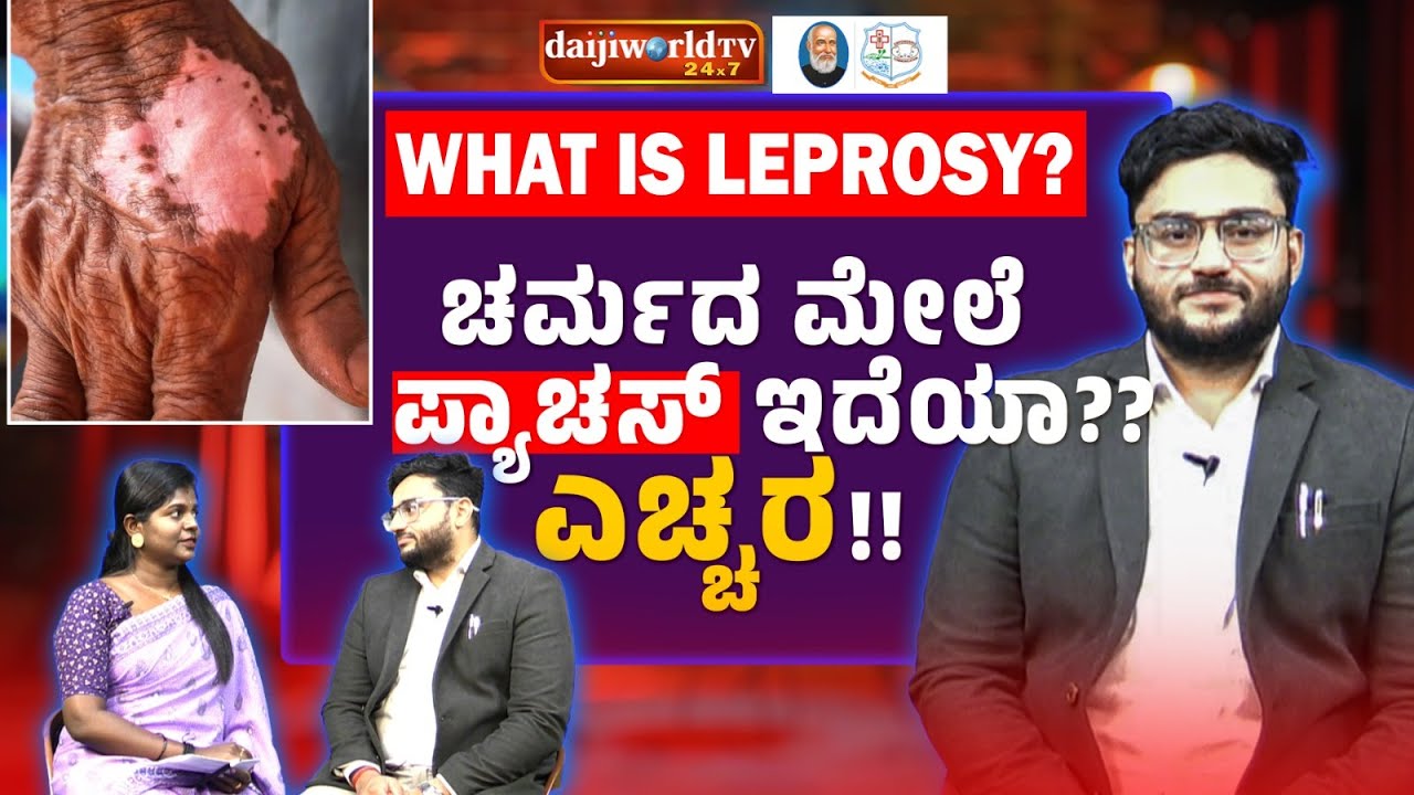 Arogya Deepa │Do people still need to be cautious about leprosy? │Dr Rahul Nayak