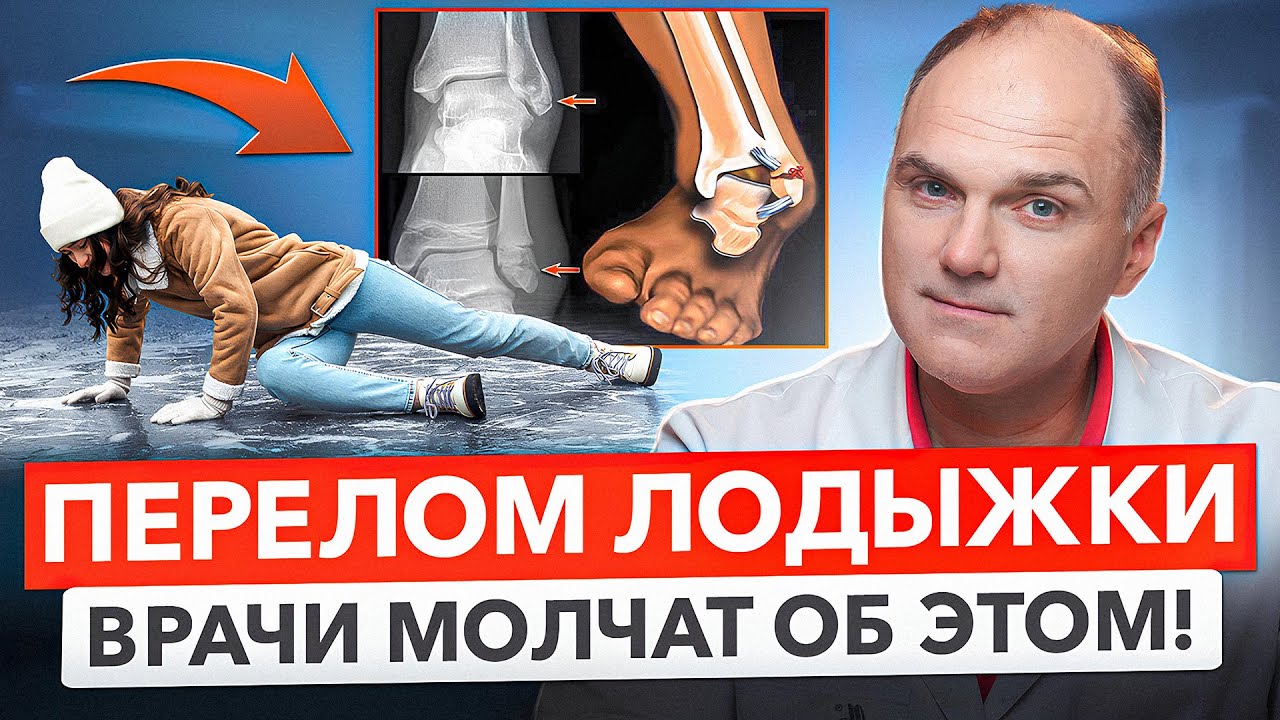 Перелом лодыжки: когда нужен гипс, а когда &mdash; операция? | Травматолог Банецкий Максим