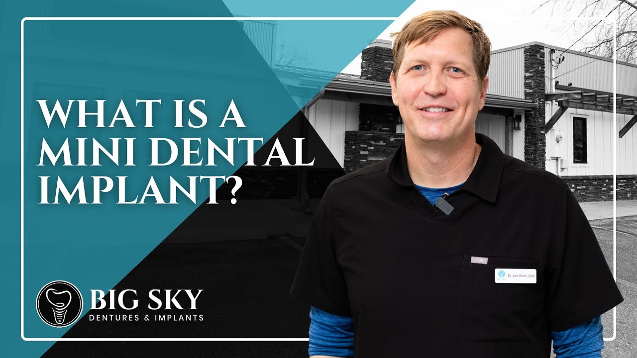 Mini Dental Implants in Missoula, MT | Big Sky Dentures & Implants