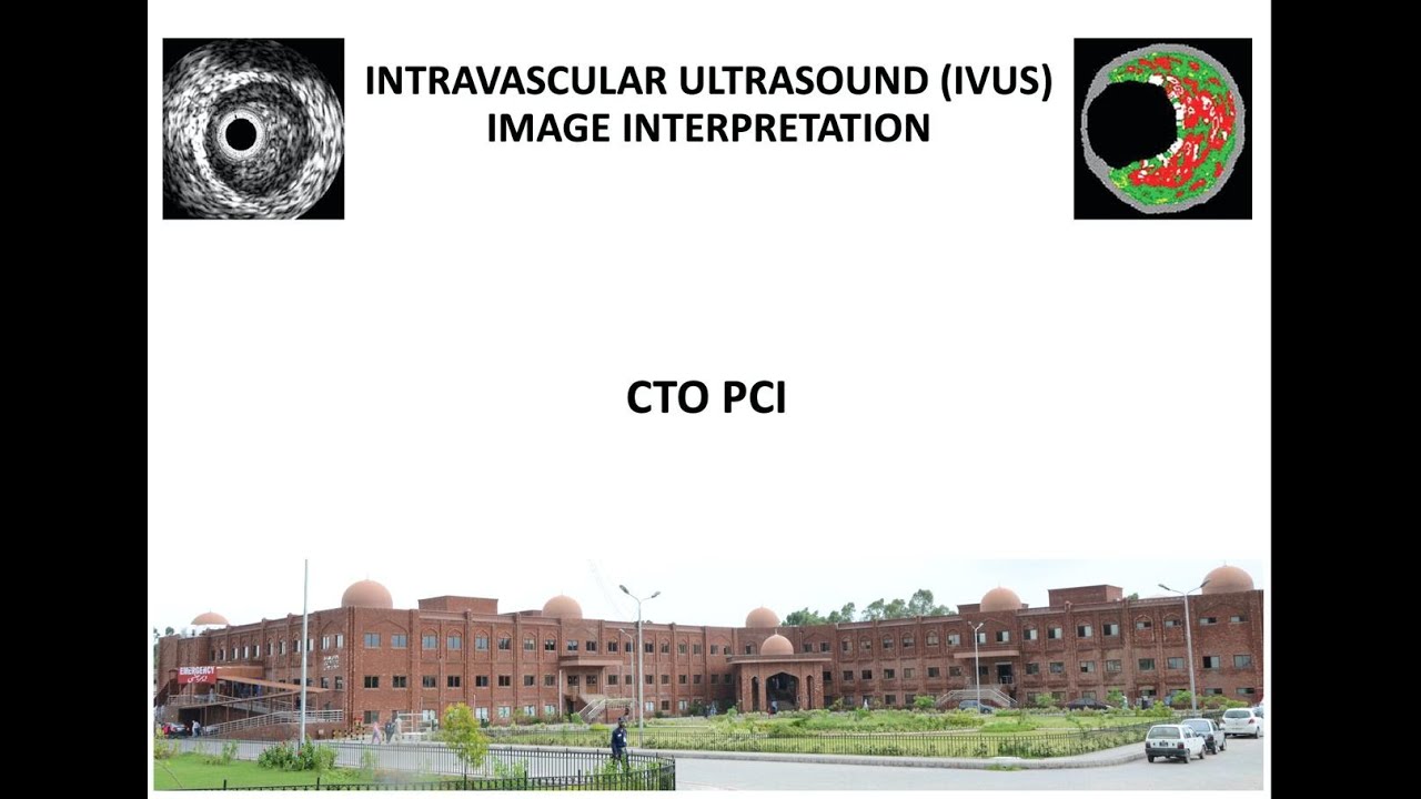 4. IVUS in CTO PCI