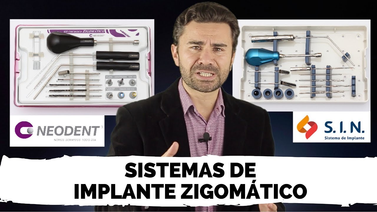Sistemas de Implante Zigomático Neodent x SIN - Qual é o melhor?