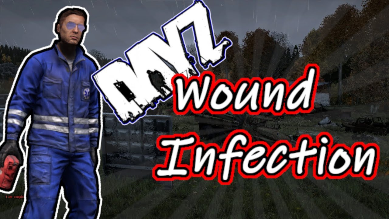 Ultimate Guide to Wound Infection Sickness Zombie Disease Tutorial DayZ 1.18 / 1.19 /1.20 Xbox PS