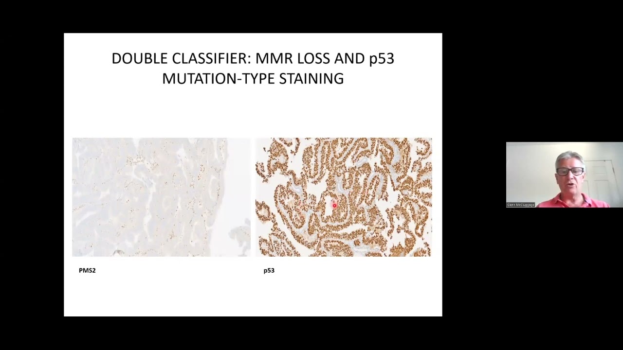 Gynecological Pathology: selected areas of endometrial carcinoma pathology