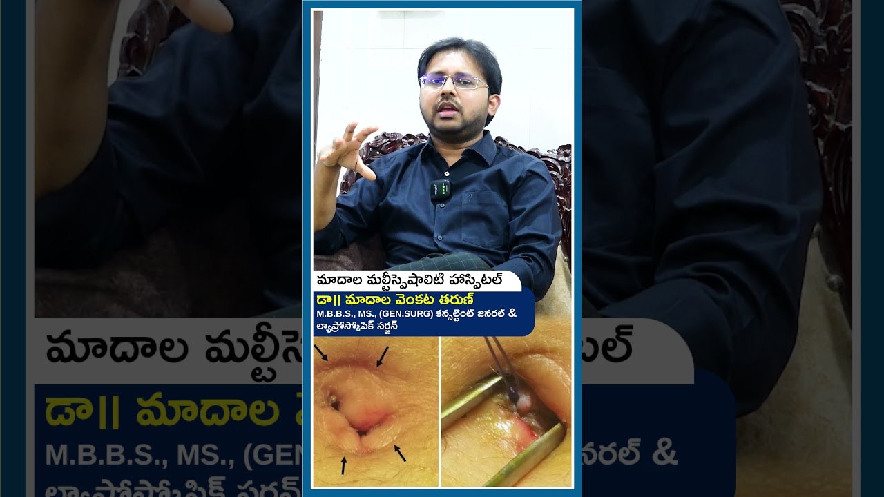 Is it dangerous if pus comes out of the belly button? #Shorts #puss ##BellyButtonInfection