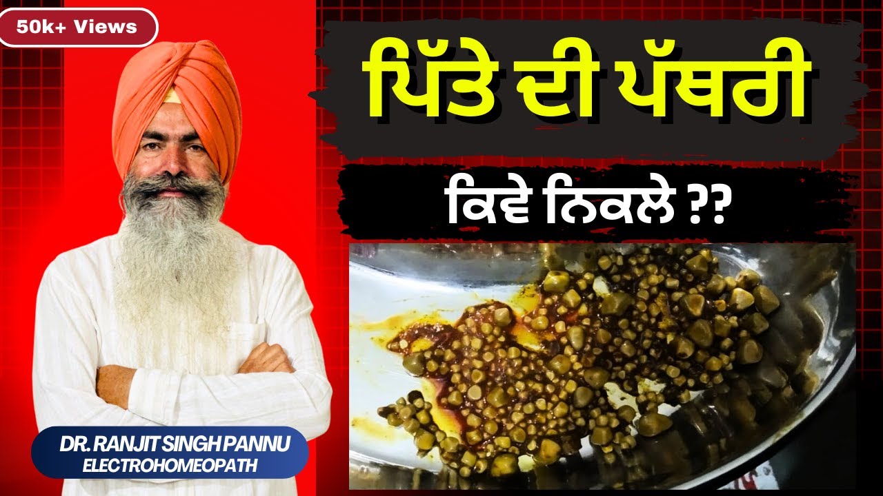 बिना ऑपरेशन पित्त की थैली में पथरी का इलाज || HOW ARE GALL STONES TREATED By Dr. Ranjit Singh Pannu