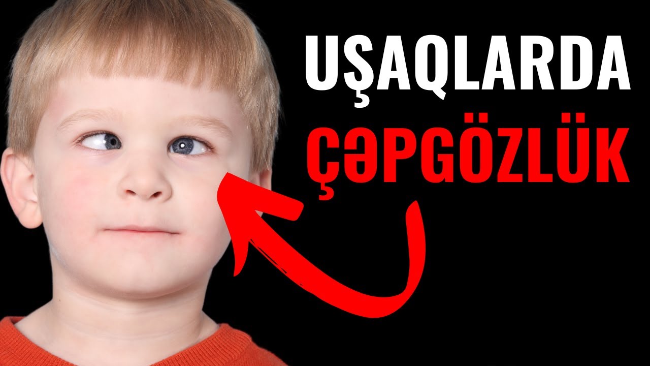 Uşaqlarda &Ccedil;əpg&ouml;zl&uuml;k varsa DİQQƏT!