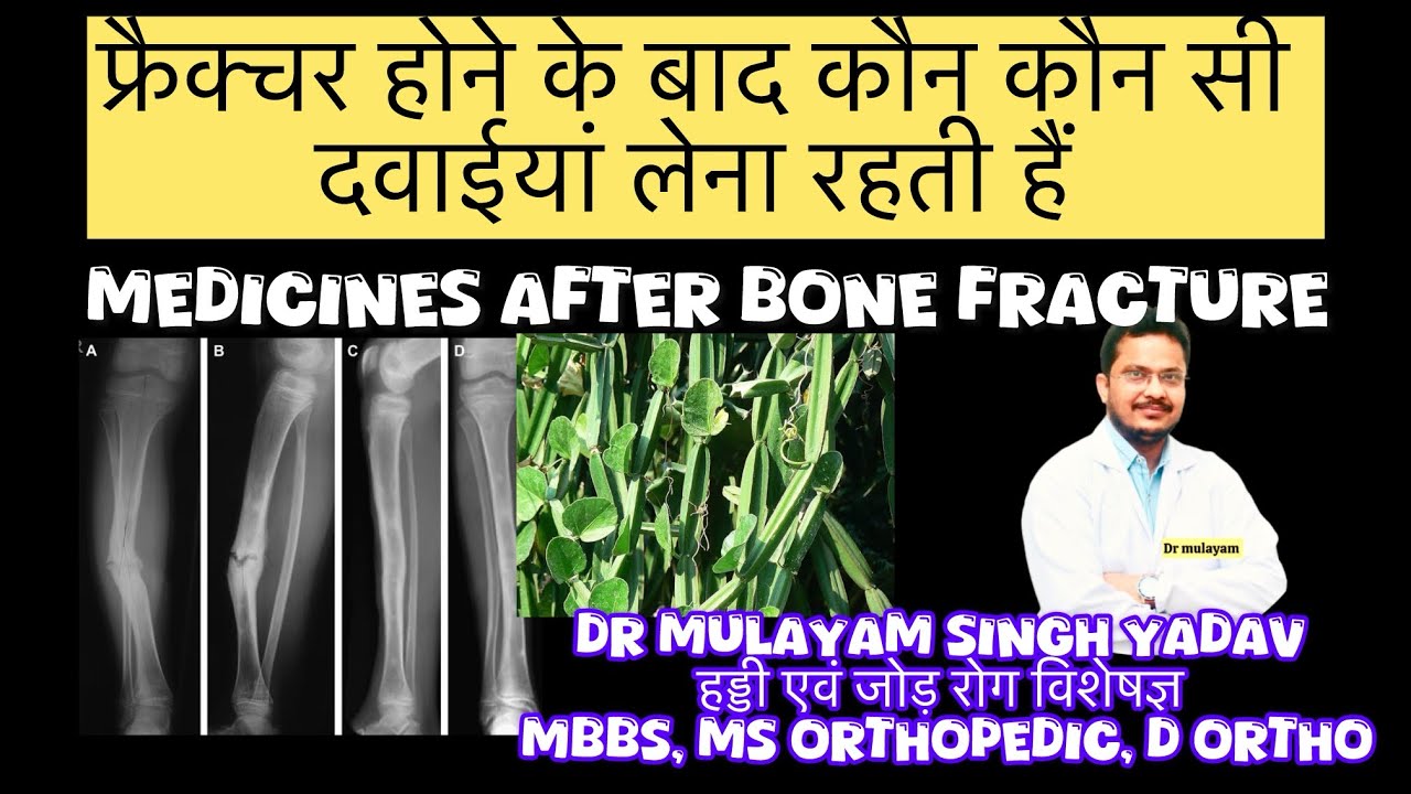 #फ्रैक्चर #होने #के #बाद #कौन #कौन #सी #दवाइयां #लेना #रहती #है (#medicines #for #fracture #heeling 