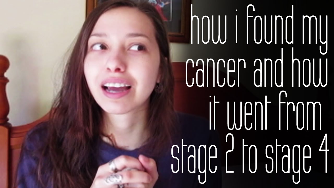 How I Found My Cancer And How It Went From Stage 2 to Stage 4 |  Hodgkin's lymphoma