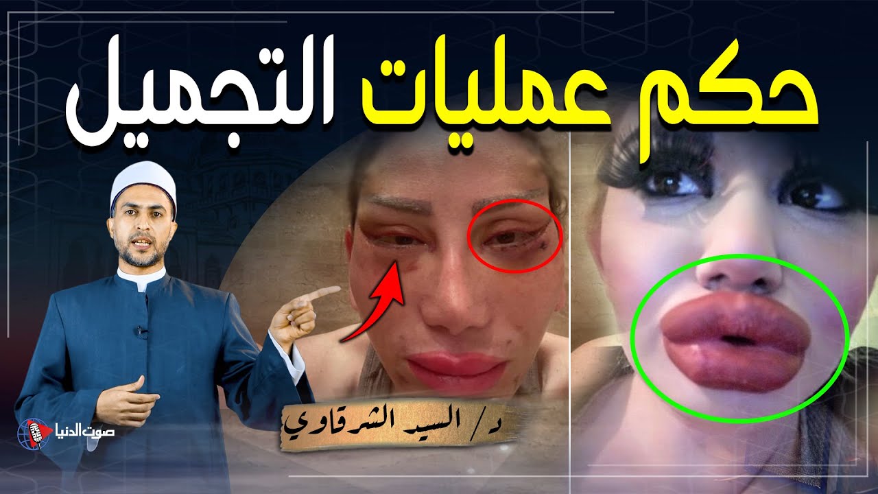 احذرووووا... عمليات التجميل بين الحلال والحرام ومتى تكون ضرورية ويجب فعلها دون تأخير؟