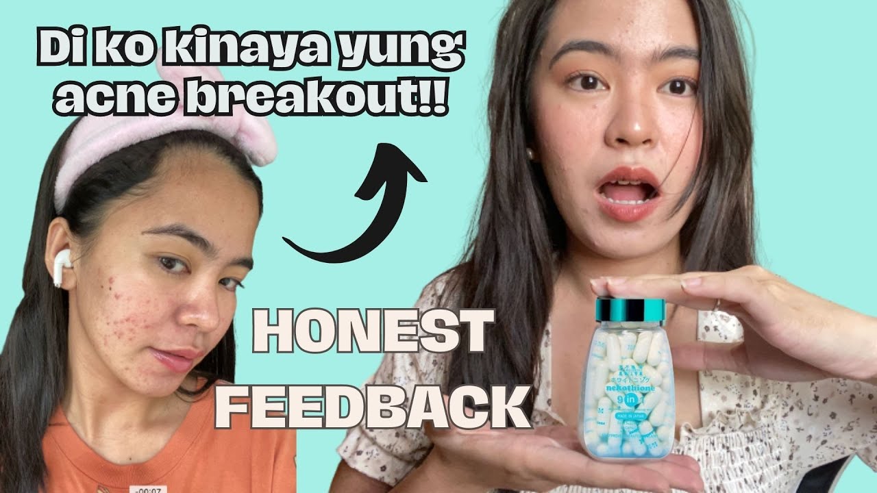 NEKOTHIONE BY KATH MELENDEZ / HONEST FEEDBACK / PRODUCT REVIEW