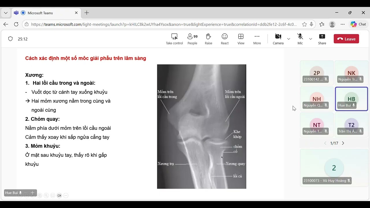 Khám khớp khuỷu