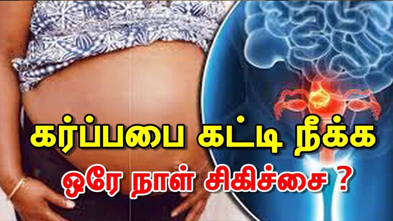 கர்ப்பபை கட்டி நீக்க ஒரே நாள் சிகிச்சை ? | uterine fibroids embolization | interventional radiology