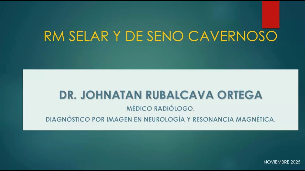 3-4 Patología del seno cavernoso por RM | Dr. Rubalcava