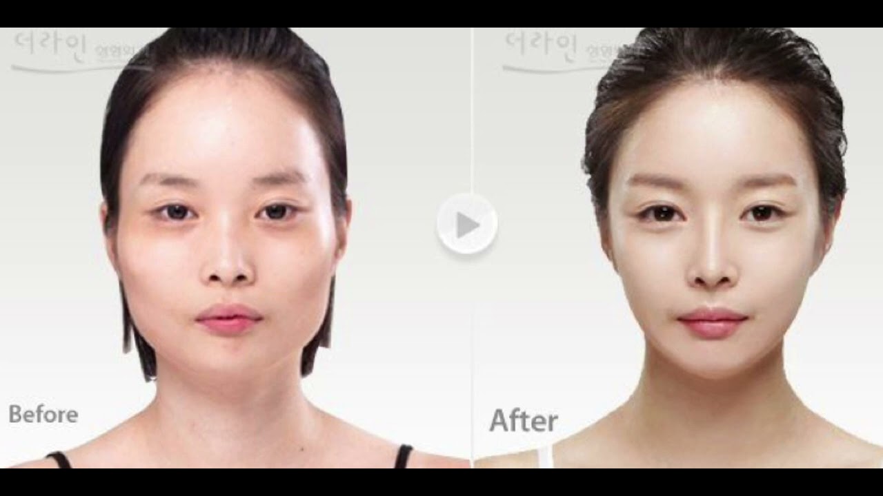 cheekbone reduction subliminal