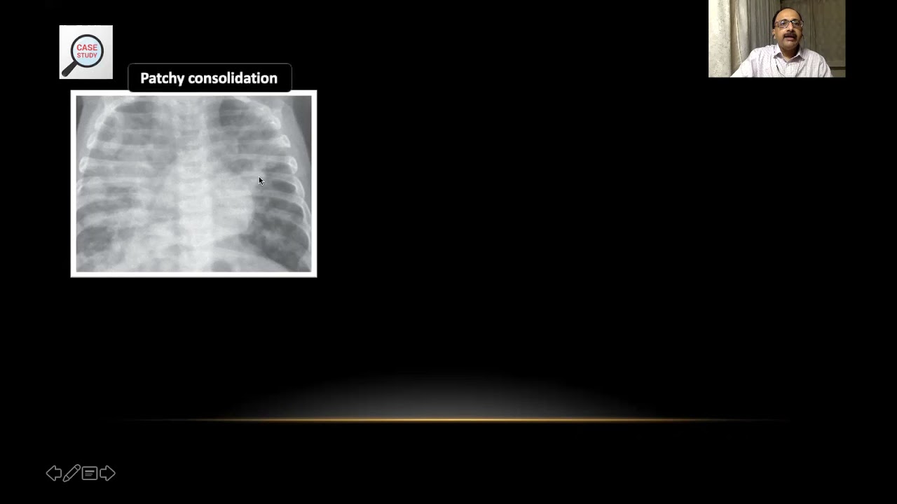 Чтение рентгенограммы грудной клетки новорожденного