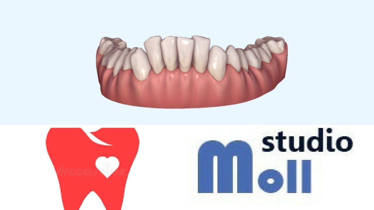 Perché ho dei denti lunghi?