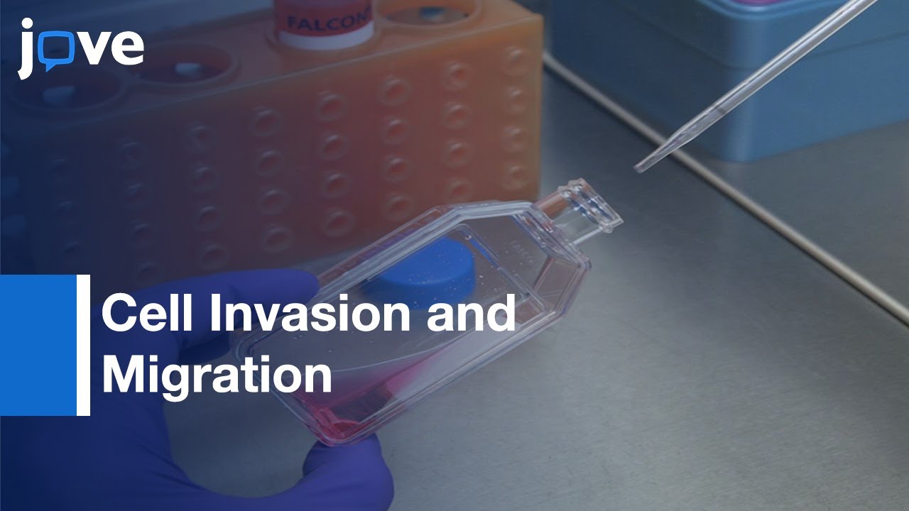 Scratch Wound Assay and Boyden Chamber Assay Comparison | Protocol Preview