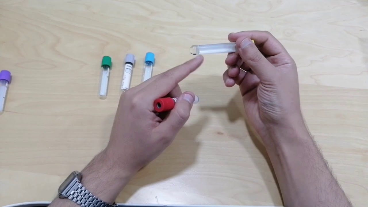 أنواع الأنابيب المستخدمه في سحب التحاليل والفرق بينها