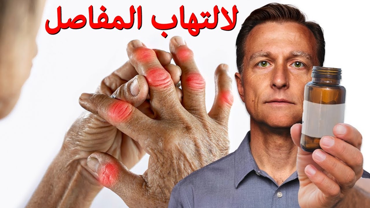 أفضل فيتامين على الاطلاق لالتهاب المفاصل (ليس فيتامين د)