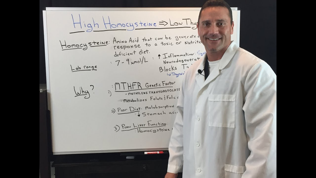 Is High Homocysteine Causing Thyroid Issues?
