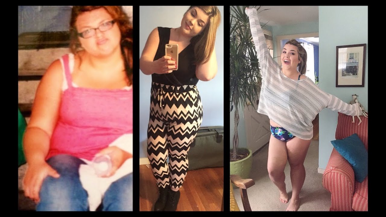 My LapBand Journey