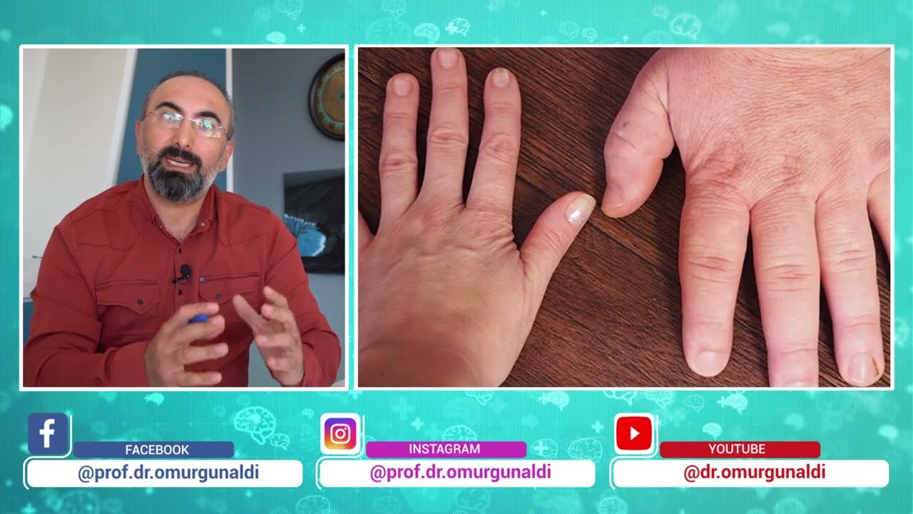 DEVLİK HASTALIĞI 