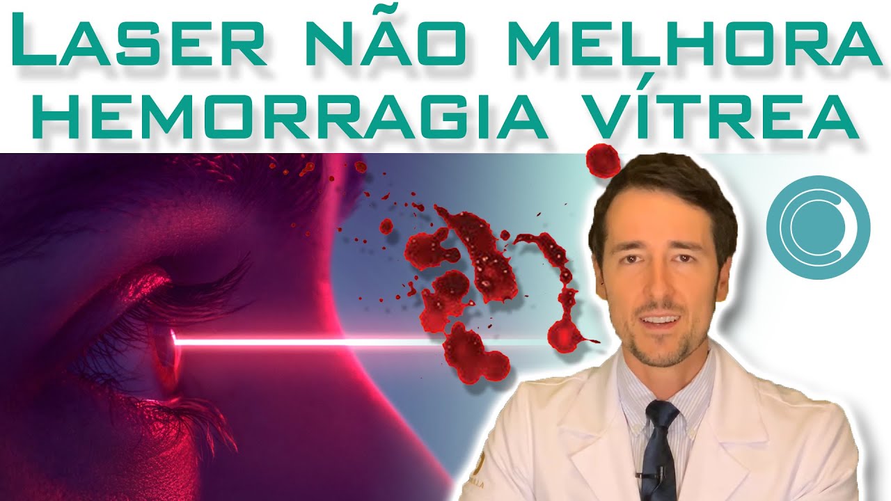 Laser não serve para tratar hemorragia vítrea!?