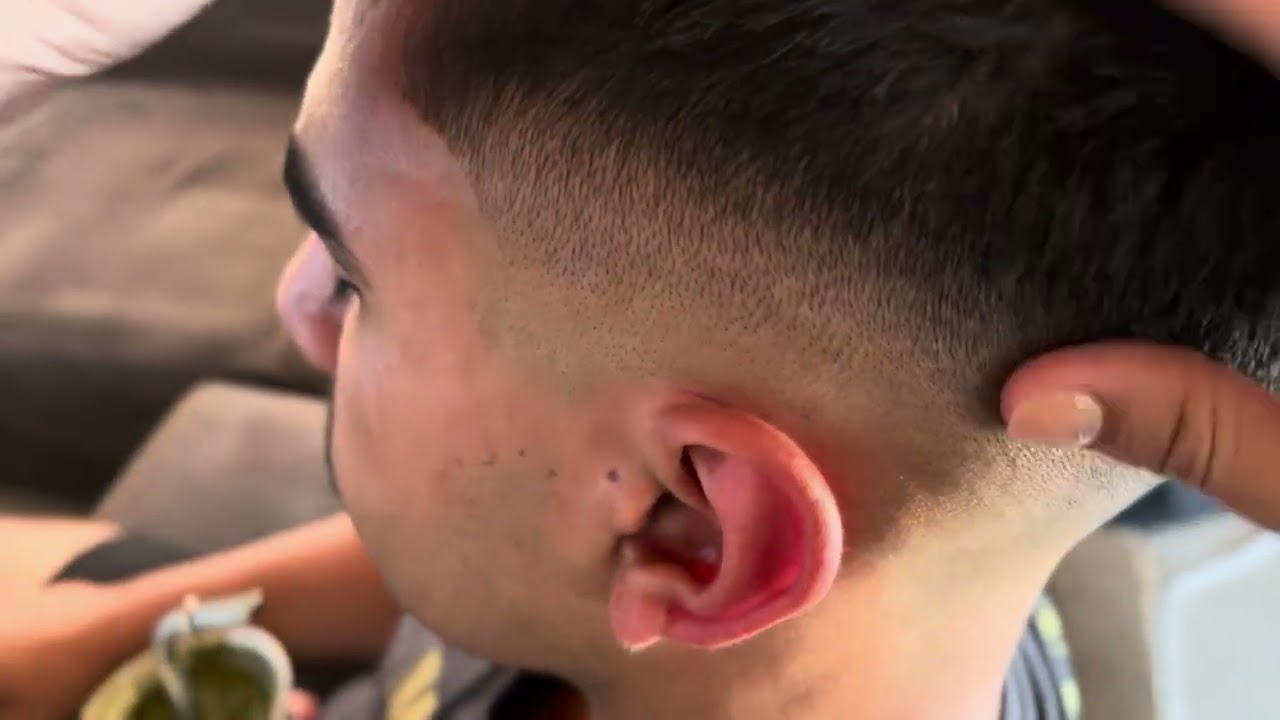 Piojitos, masaje y rasco cabeza ASMR En primera persona 