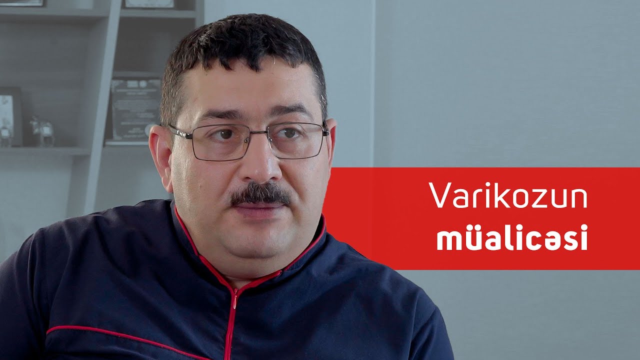 Varikozun müalicəsi 